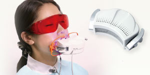 オフィスホワイトニング