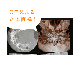 的確な診断で治療の質を上げる！（CTによる立体画像！）