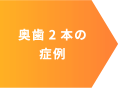 奥歯2本の症例