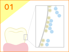 歯の表面に付着したステイン（茶しぶやタバコのヤニなど）に近づくと、